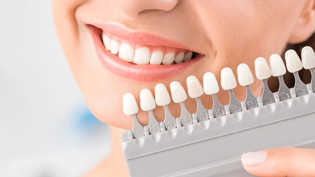 Enhancing Your Smile: Oral Science and the Tooth Color Chart and Whitening Strips
